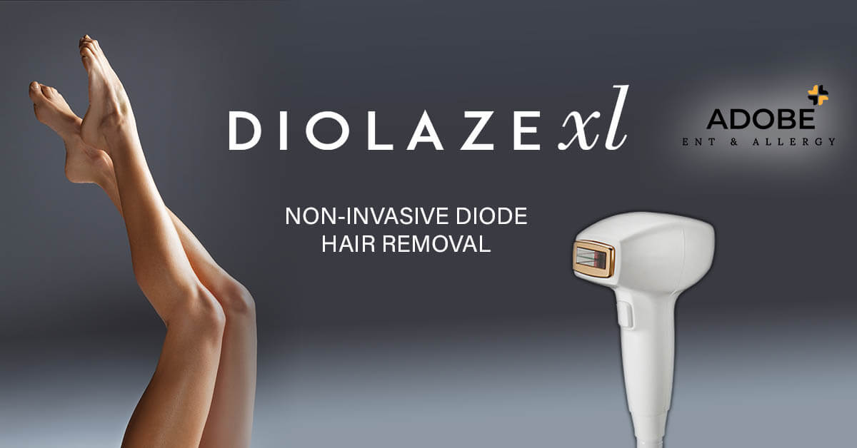 Diolaze Non-Invasive Diode Hair Removal
